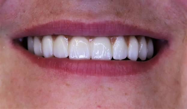 Slider image (4) Dentech Dental Centar